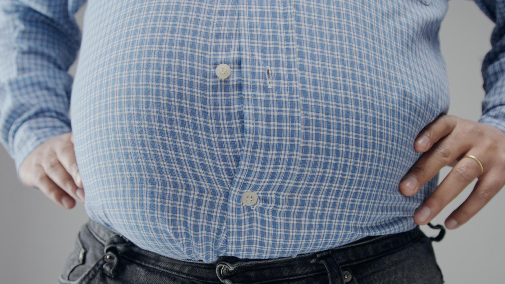 obesity, fat