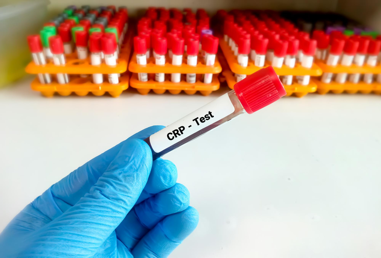 CRP Test