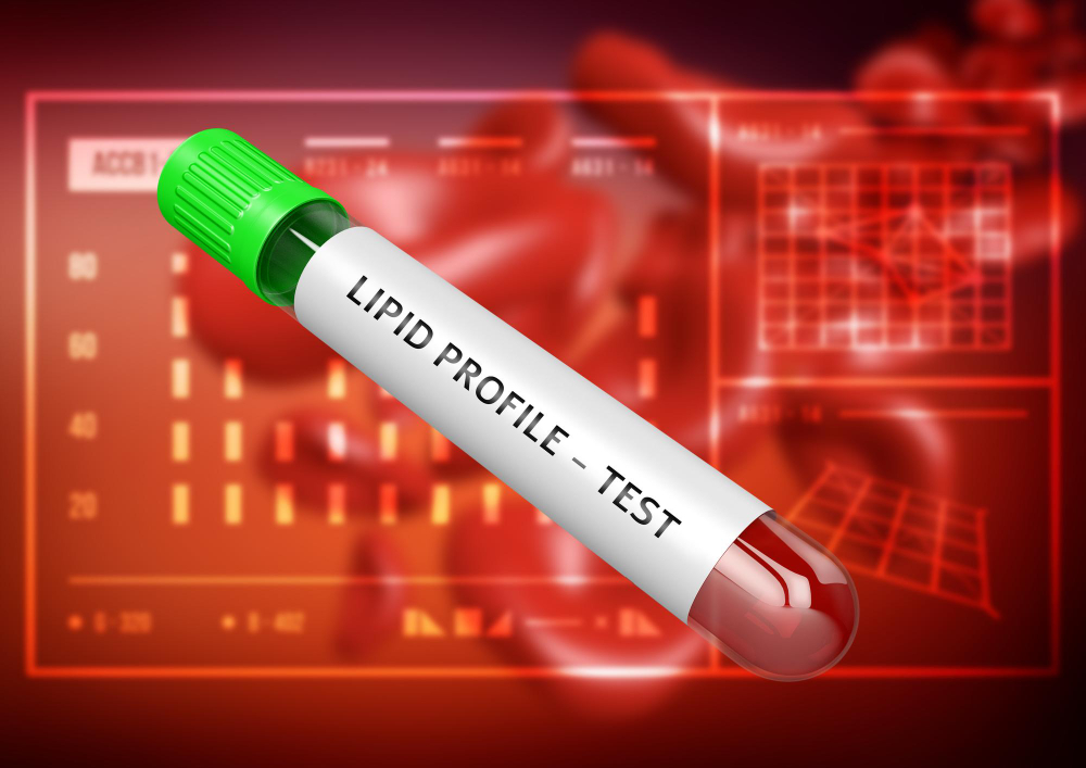 lipid profile