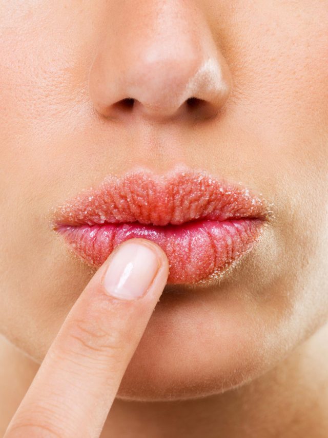 How to treat chapped lips naturally