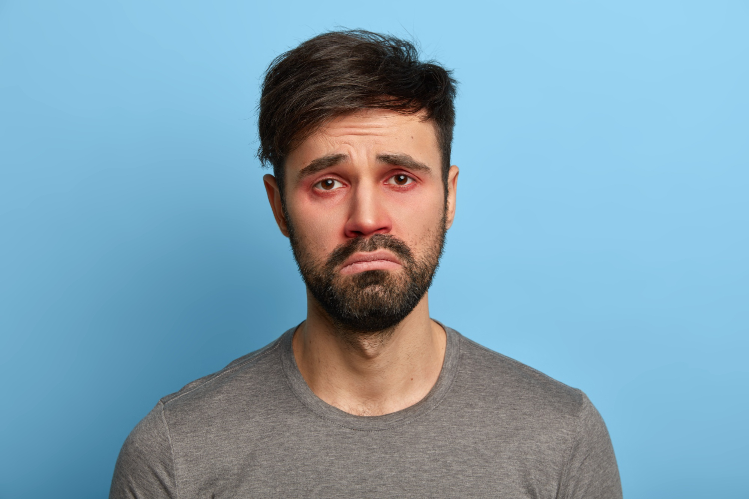 Cortisol Face: The Viral Term That Has Everyone Looking in the Mirror Cortisol Face: The Viral Term That Has Everyone Looking in the Mirror