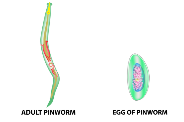 Pinworm home remedy