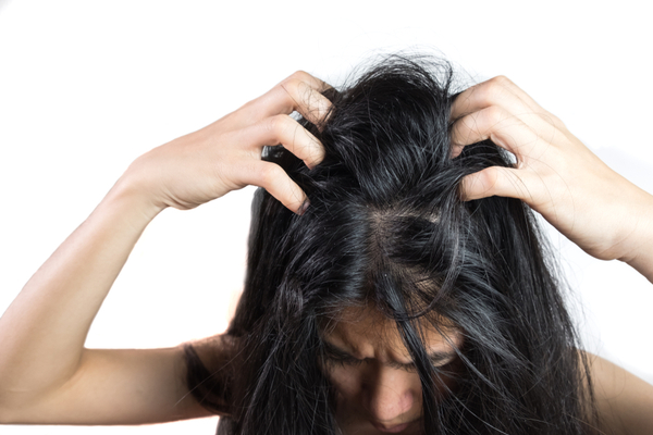 Symptoms of Itchy Scalp