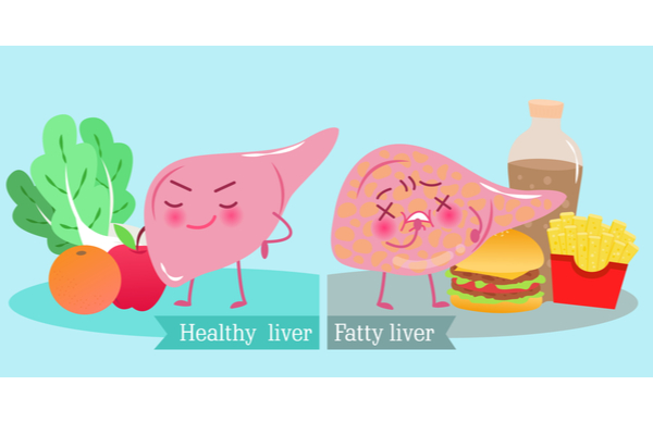 Healthy and Fatty Liver