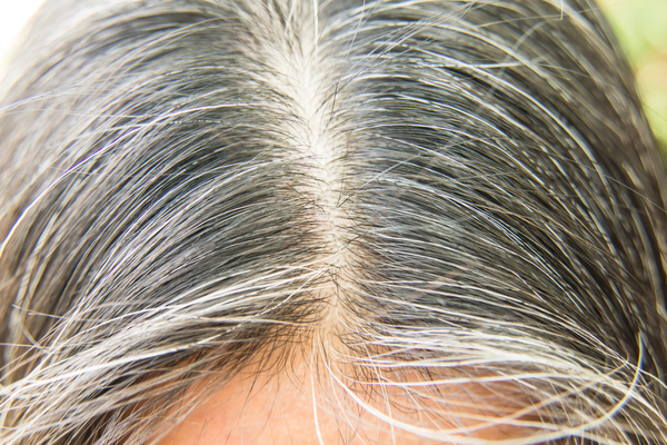 Home Remedies for Grey Hair | सफेद बालों का इलाज | सफेद बालों का तेल