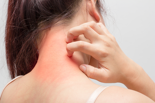 Benefits of chaulai in skin disease